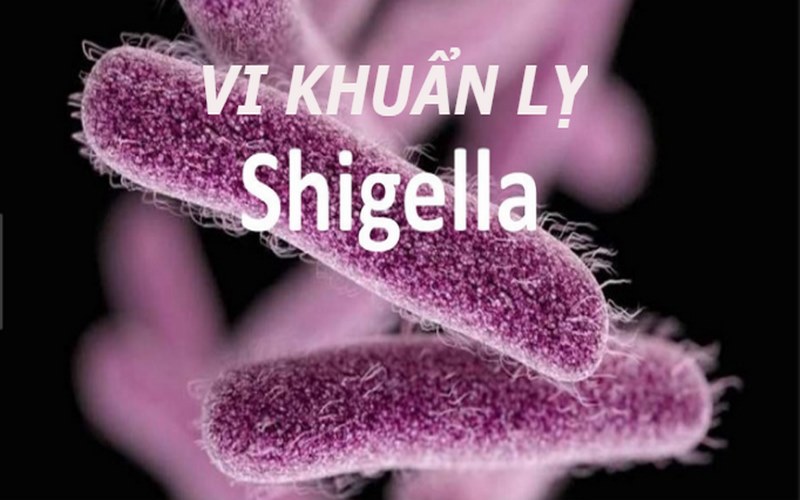 Hình ảnh minh họa trực khuẩn Shigella gây bệnh lỵ