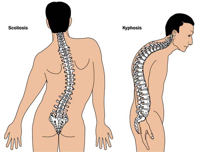 Nếu mắc bệnh cần kiểm tra định kỳ