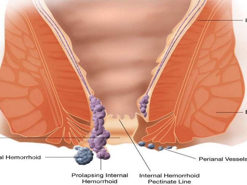 Viêm nhiễm do vi khuẩn, nấm hoặc virus