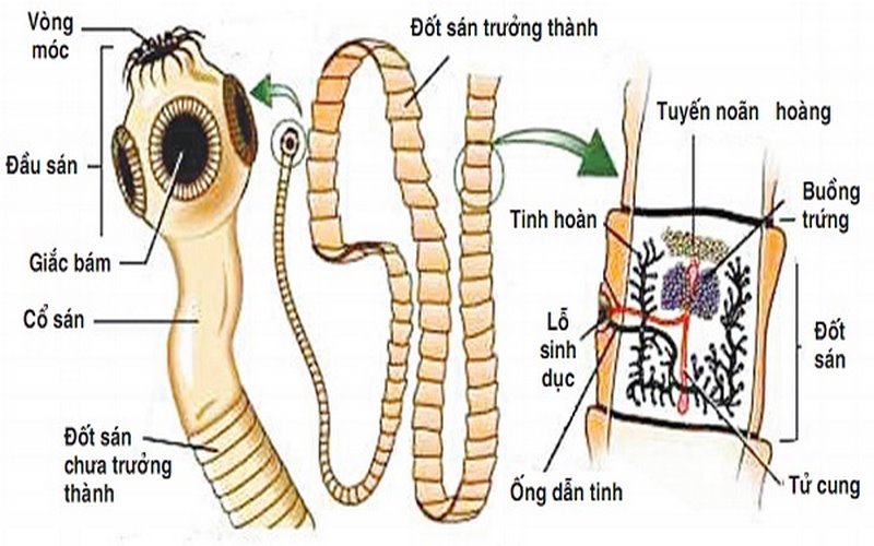 Bệnh ấu trùng sán dây lợn (cysticercosis) do Cysticercus cellulosae