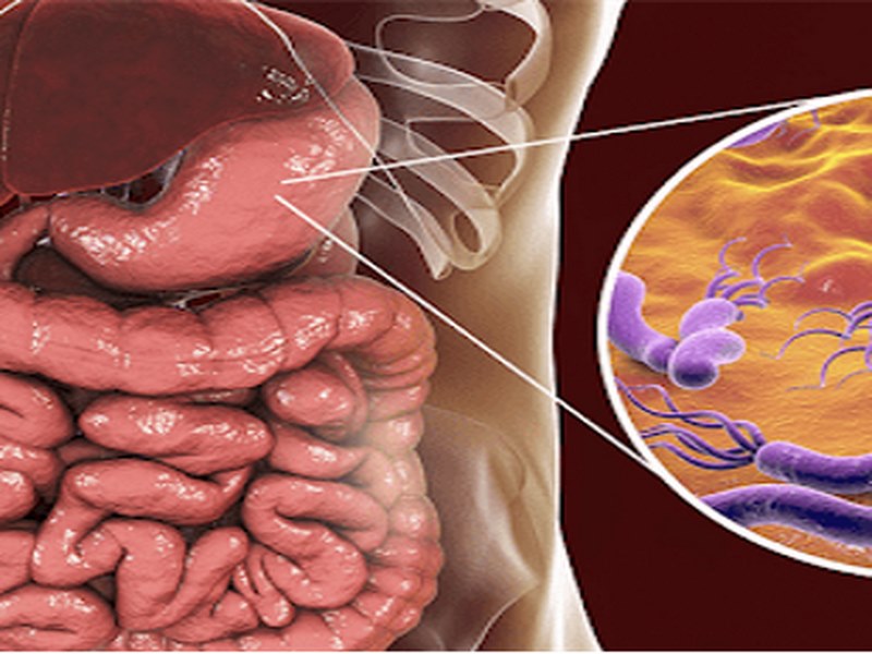 Nhiễm H.pylori (HP) là gì?