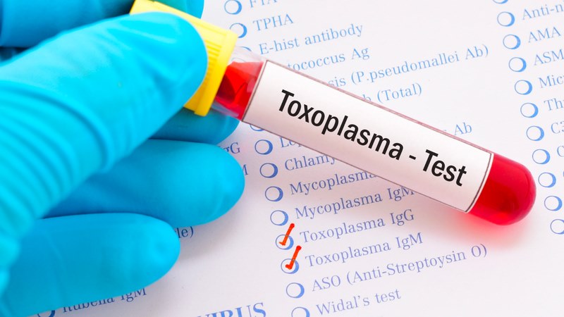 Xét nghiệm nhiễm Toxoplasma có thể được thực hiện để chẩn đoán 