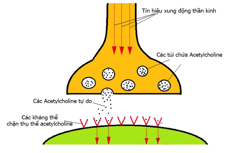 Ở bệnh lí nhược cơ, tồn taị các kháng thể tự miễn khiến nối chéo các thụ thể