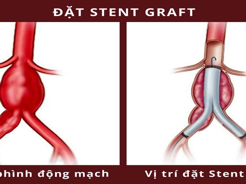 Duy trì một lối sống lành mạnh