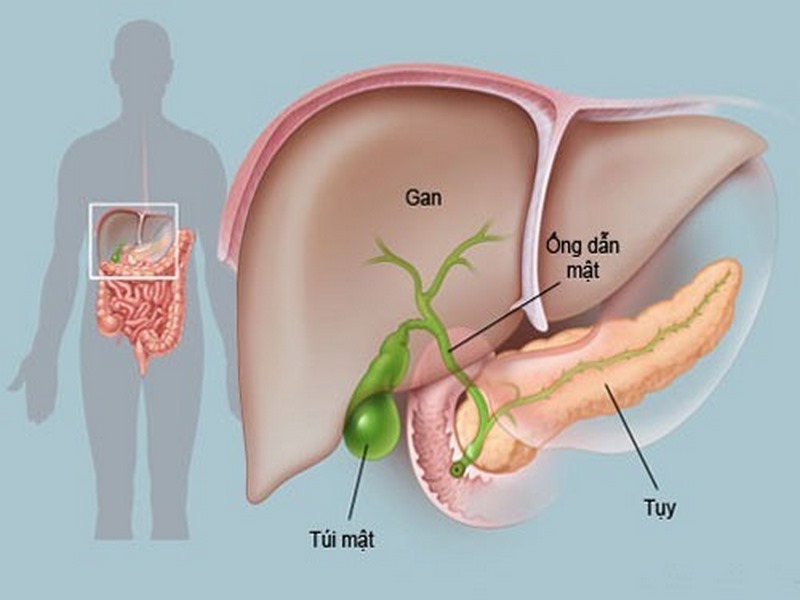 Uống rượu quá mức và hút thuốc lá cũng là yếu tố tăng nguy cơ mắc bệnh