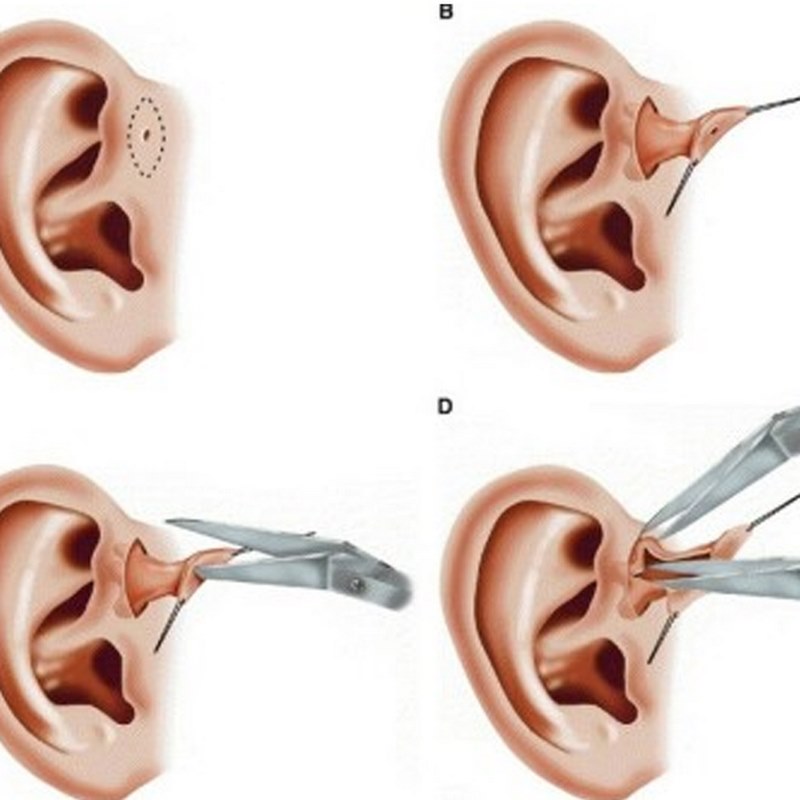 Cần gặp bác sĩ ngay lập tức nếu bạn thấy các triệu chứng nghiêm trọng