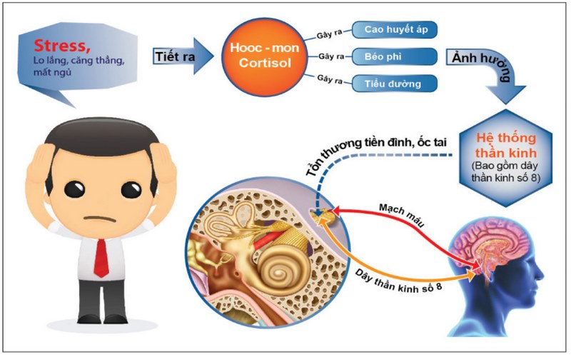 Bệnh rối loạn tiền đình là gì