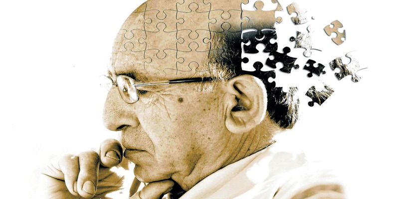 Bệnh Alzheimer có thể dẫn đến rối loạn ý thức theo thời gian