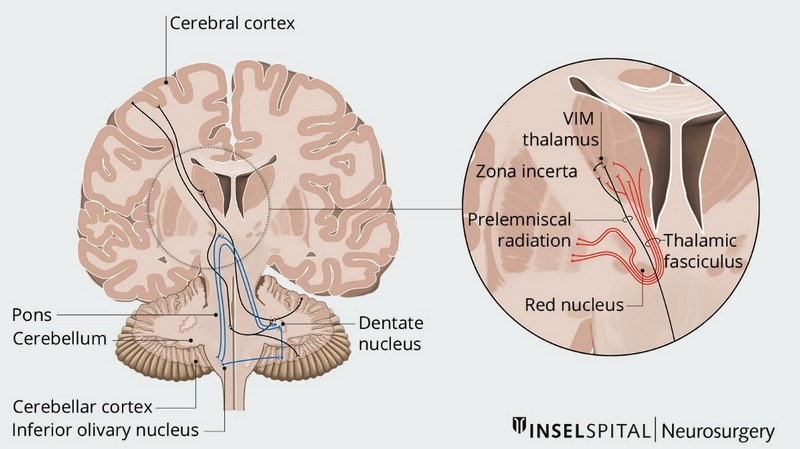 Phương pháp chuẩn đoán và điều trị