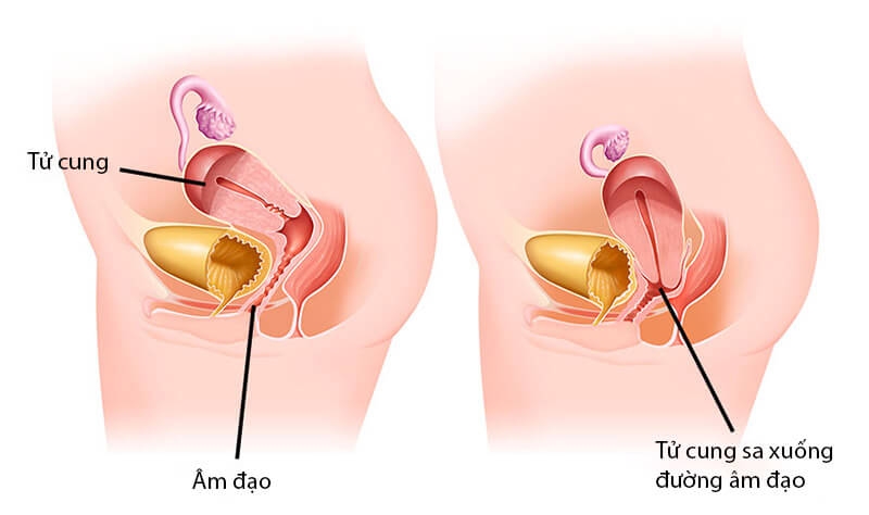 Phương pháp chuẩn đoán và xét nghiệm