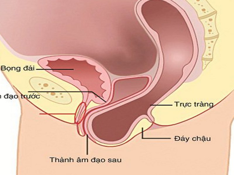 Sa trực tràng là gì?