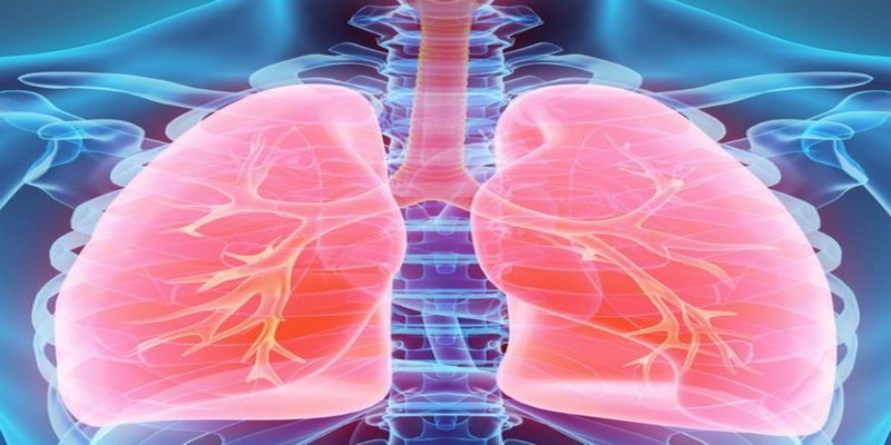  Sarcoidosis là gì?