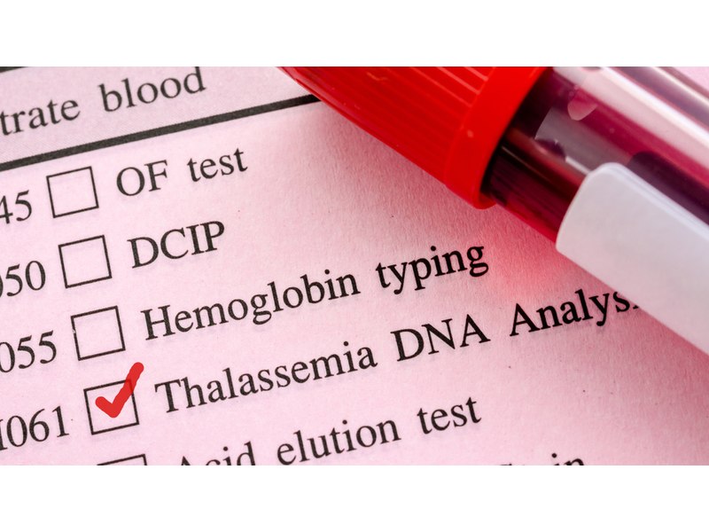 Bệnh Thalassemia là nguyên nhân gây thiếu máu tán huyết