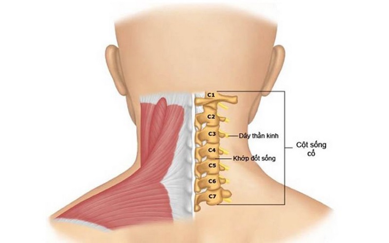 Thoái hóa có thể xuất hiện ở bất kỳ vị trí nào trên cột sống cổ