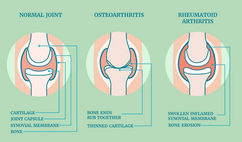 Chế độ sinh hoạt và phòng bệnh hiệu quả