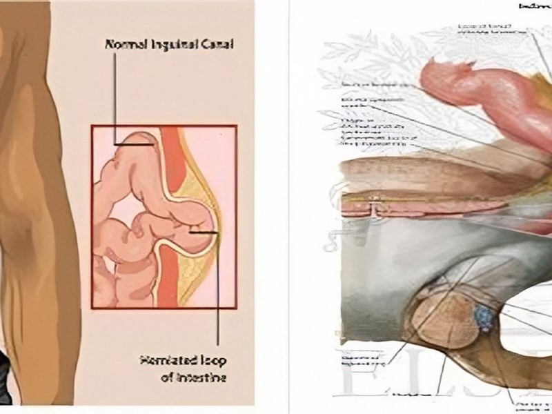 Các bất thường về cấu trúc của niêm mạc dạ dày