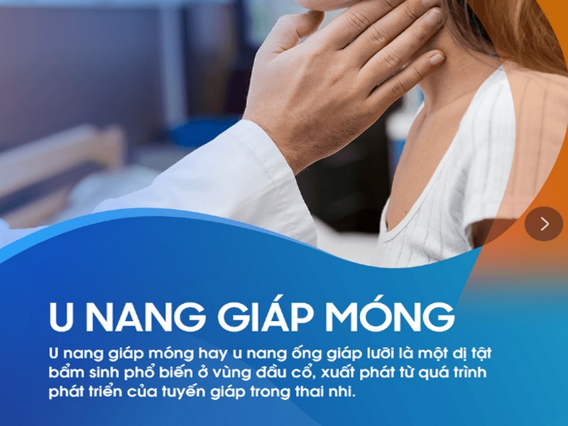 U nang giáp móng là gì?