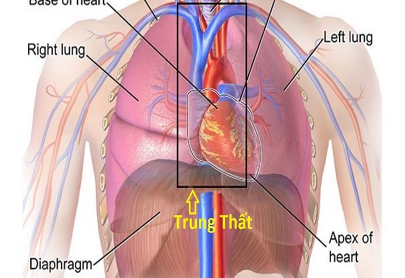 U trung thất là một bệnh lý hiếm gặp và thường nằm trong độ tuổi từ 30 đến 50