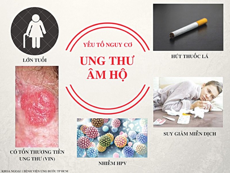 Những ai có nguy cơ mắc bệnh