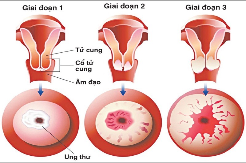 Khi nào cần gặp bác sĩ để chữa trị