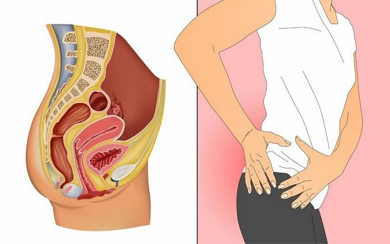 Ung thư hậu môn đại diện cho phần lớn các bệnh ung thư phát sinh trong ống hậu môn