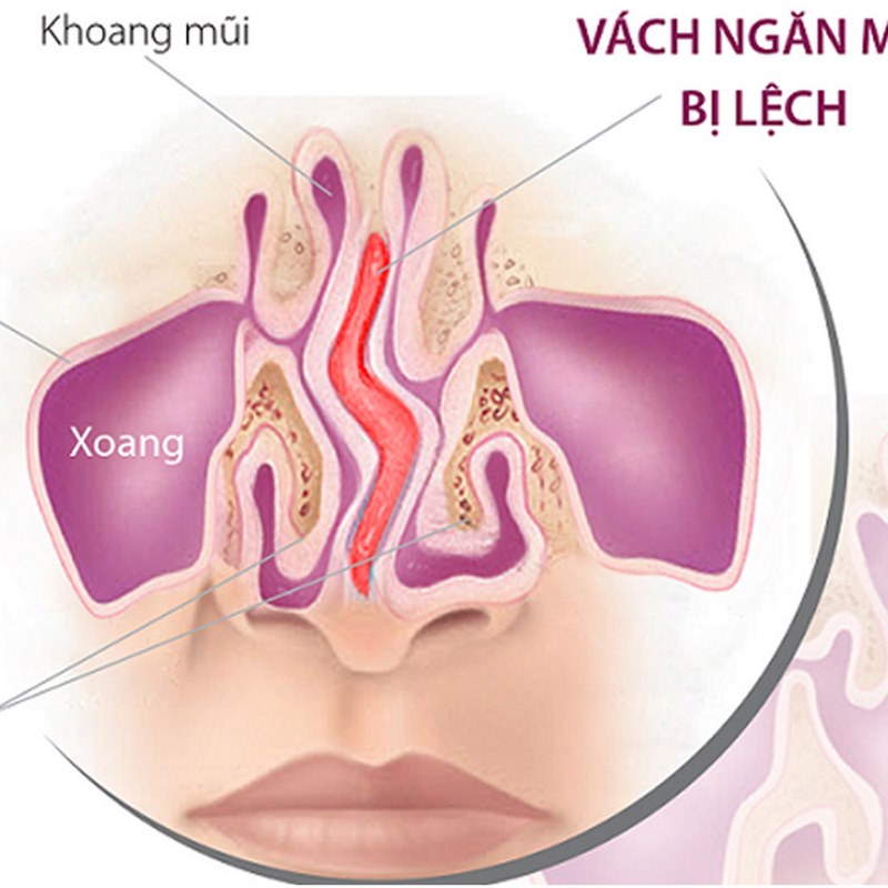 Bác sĩ sẽ đánh giá tình trạng và đưa ra phương pháp điều trị phù hợp