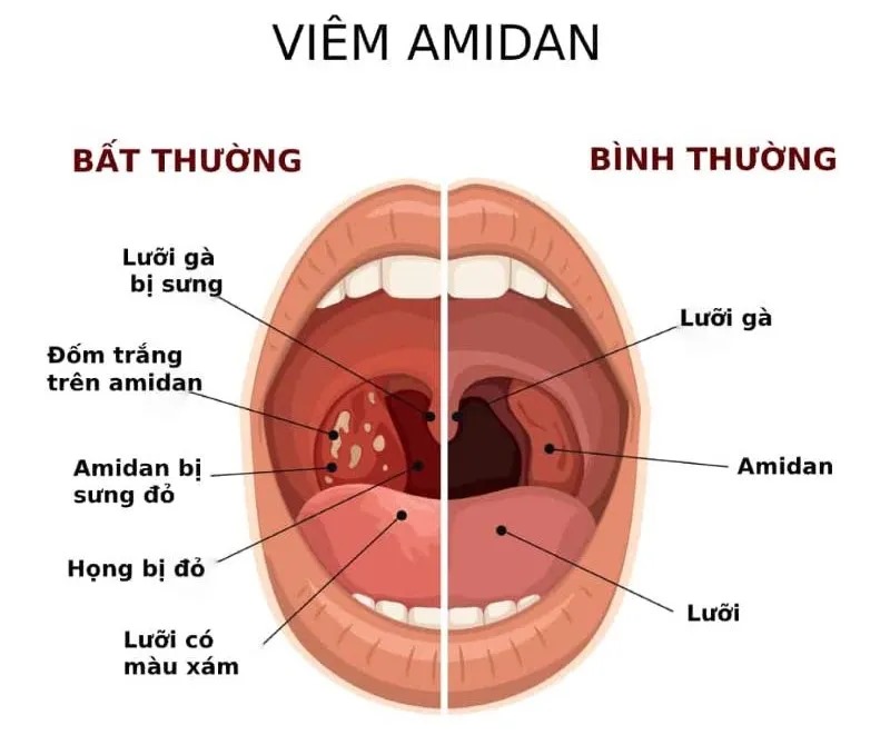 Bị sưng nề hoặc cảm giác đau khi vặn cổ cần tham khám ngay