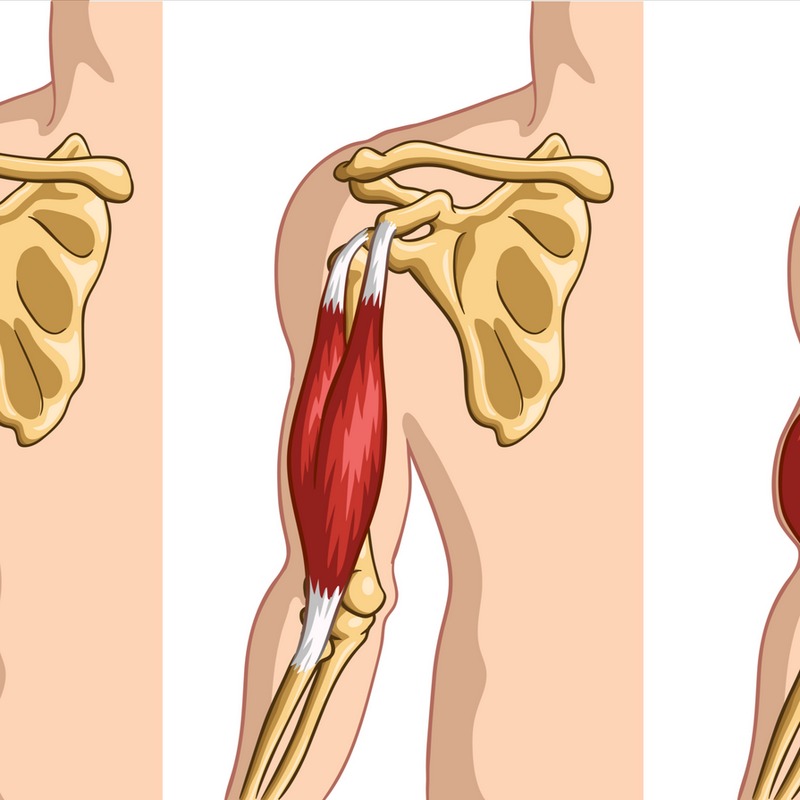 Tìm hiểu chung về viêm gân nhị đầu vai