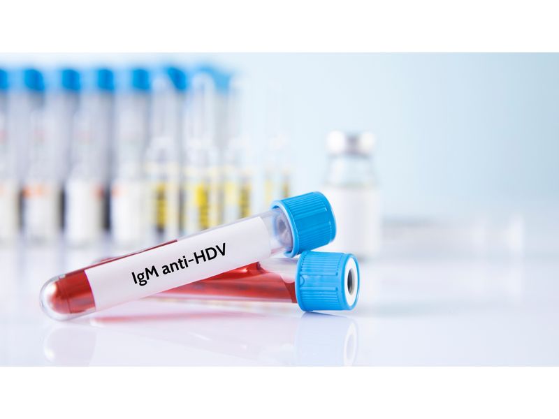 Xét nghiệm kháng thể IgM kháng virus HDV