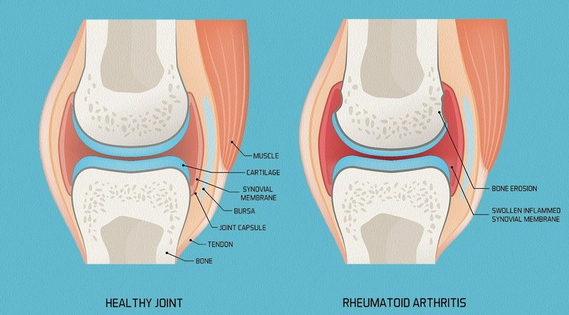 Phương pháp chuẩn đoán và điều trị bệnh