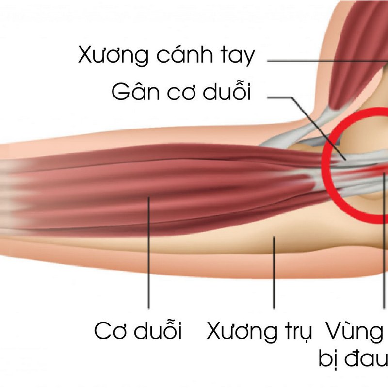 Phương pháp chuẩn đoán phát hiện bệnh và điều trị