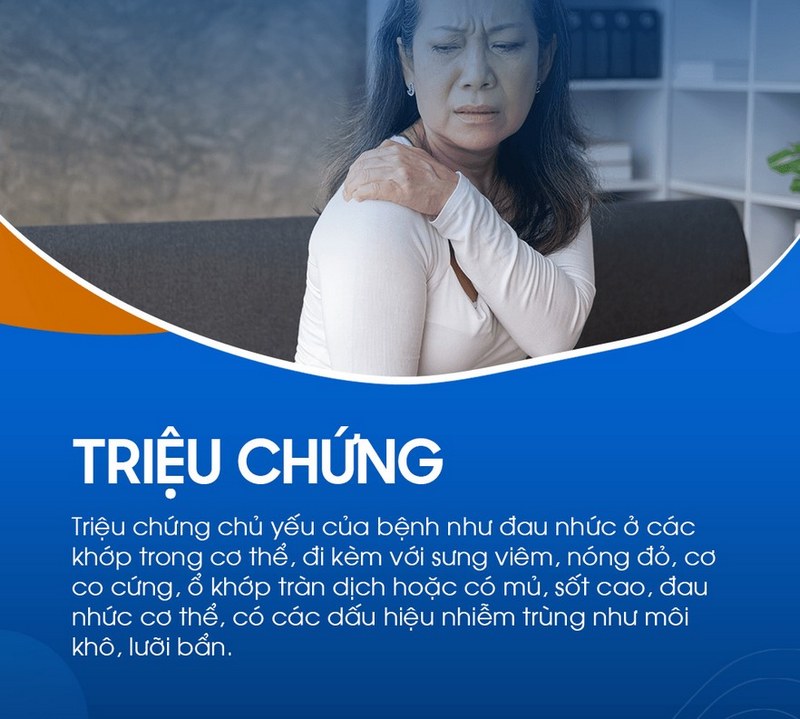 Tìm hiểu chung về viêm khớp liên cầu