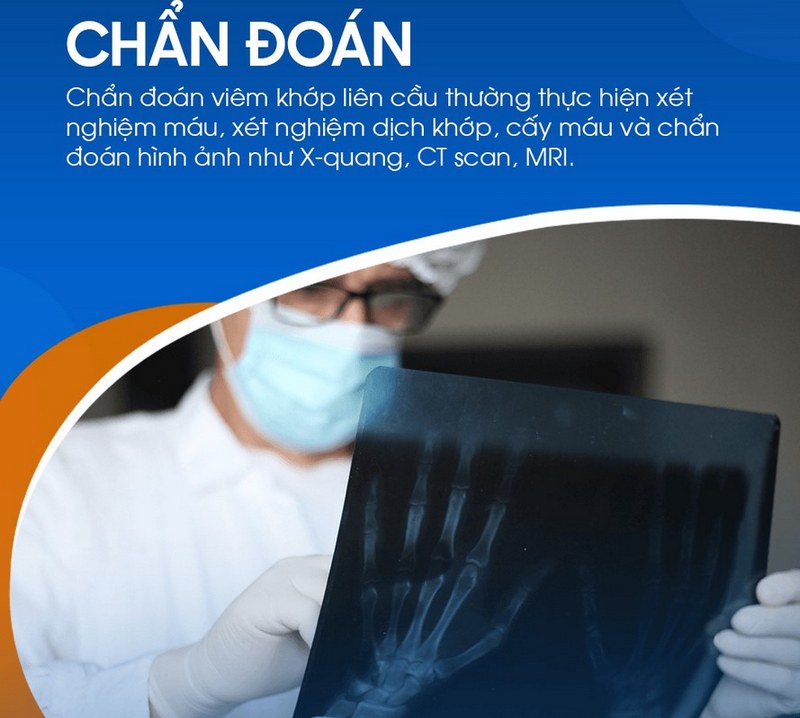 Phương pháp chuẩn đoán bệnh và điều trị