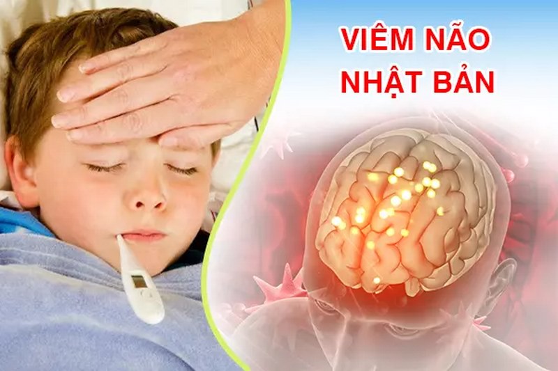 Bệnh nhân sẽ có cảm giác sốt cao không giảm sau khi sử dụng thuốc hạ sốt