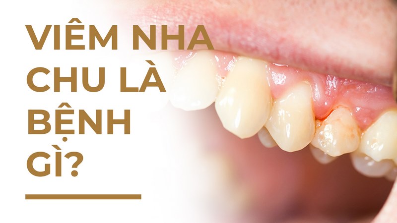 Chăm sóc vệ sinh răng miệng hàng ngày để phòng bệnh