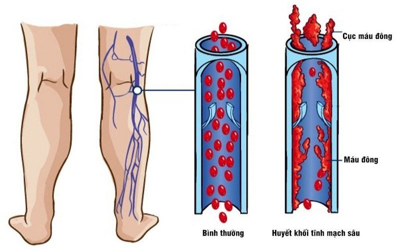 Tĩnh mạch là hệ thống mạch máu có vai trò dẫn máu trở về từ các cơ quan đến tim