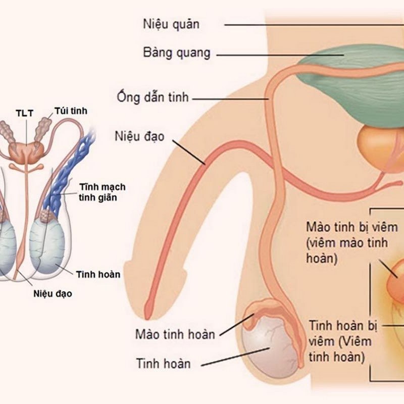 Người bệnh cần tạo điều kiện cho cơ thể nghỉ ngơi đầy đủ để phục hồi sức khỏe