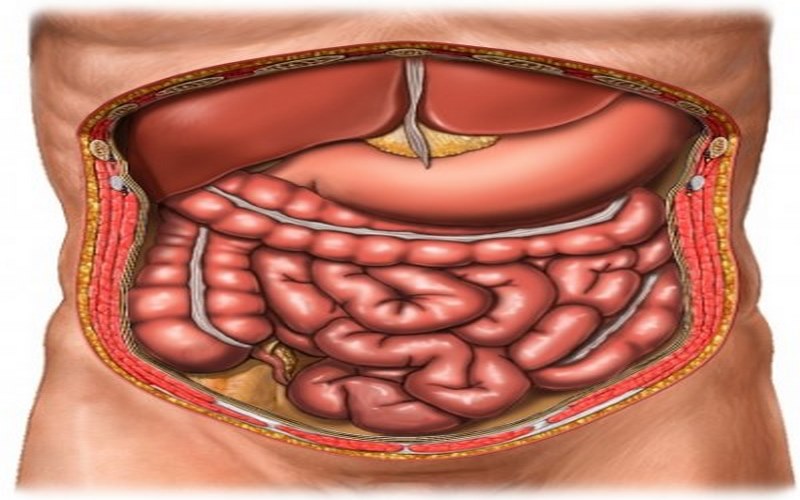 Viêm túi thừa đại tràng gây ra biến chứng viêm phúc mạc, cần được cấp cứu kịp thời.