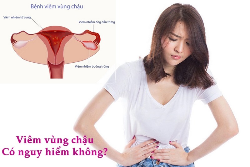 Dấu hiệu và triệu chứng của bệnh