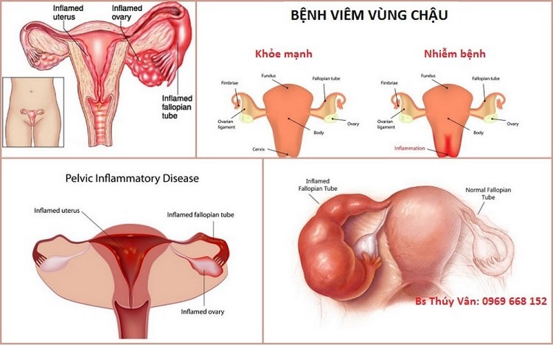 Phương pháp chẩn đoán & điều trị bệnh