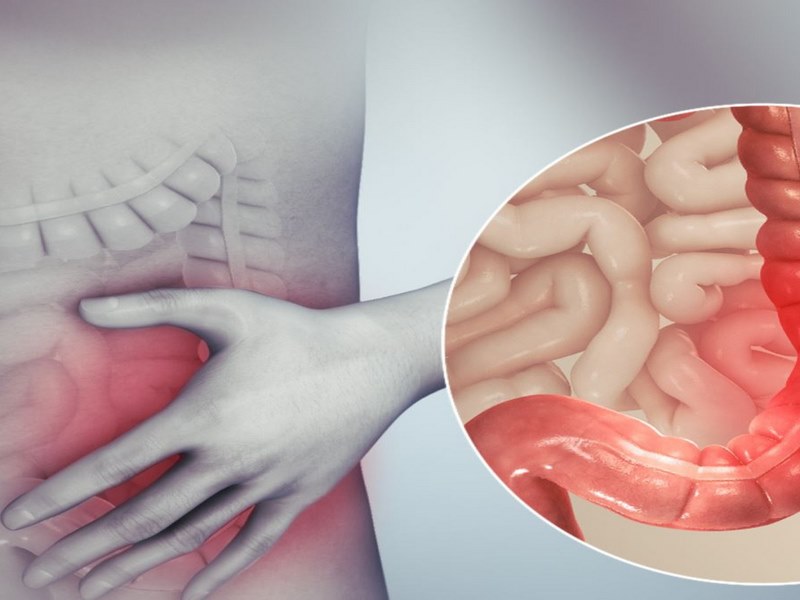 Vi khuẩn Clostridium difficile là nguyên nhân phổ biến của viêm 