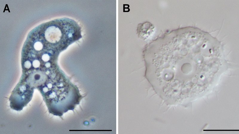 Acanthamoeba dạng hoạt động và dạng nang