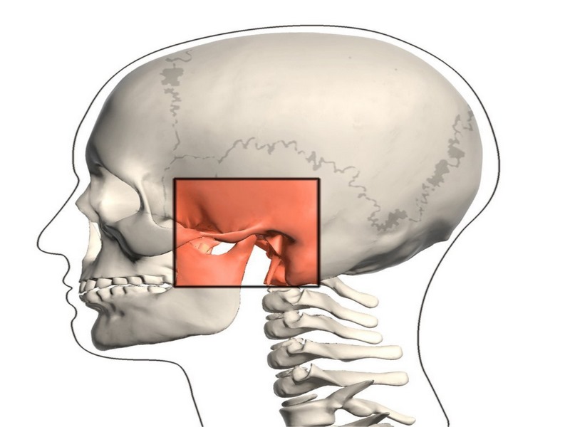 Viêm khớp thái dương hàm là gì?