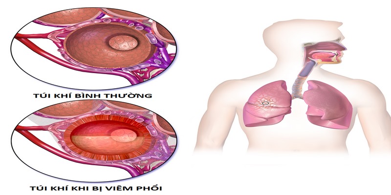 Cảm thấy đau đầu, mệt mỏi nặng