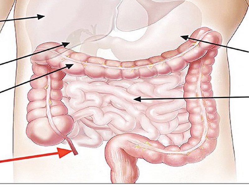 Các triệu chứng như sốt ở cả hai phía ngực