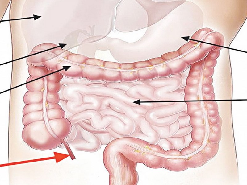 Vi khuẩn có thể phát triển trong ruột và gây viêm nhiễm ruột thừa