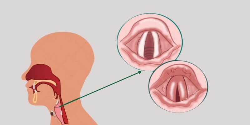 Duy trì môi trường sống sạch sẽ và thông thoáng