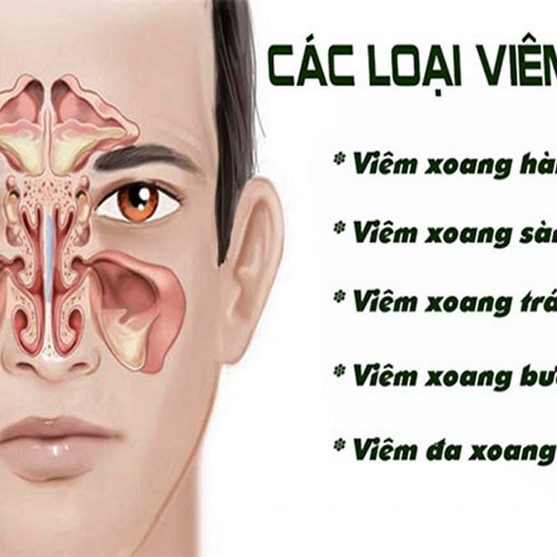 Người có thói quen hút thuốc lá có nguy cơ bị viêm xoang