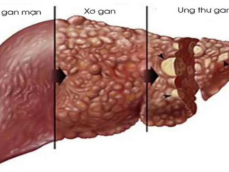 Cảm thấy mệt mỏi, yếu đuối