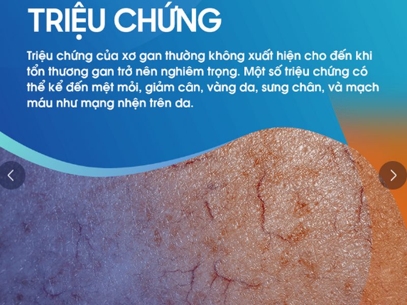 Hạn chế tiêu thụ rượu, thuốc lá và các chất gây hại khác cho gan